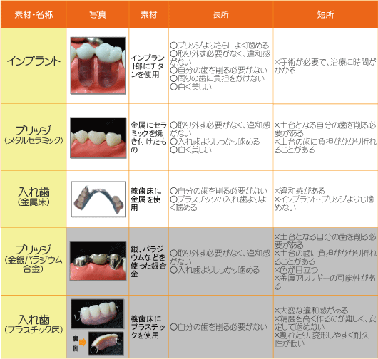 失ってしまった歯の治療