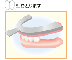 1,型をとります