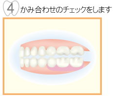 4,かみ合わせのチェックをします