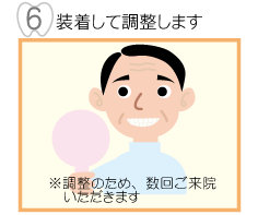 6,装着して調整します。