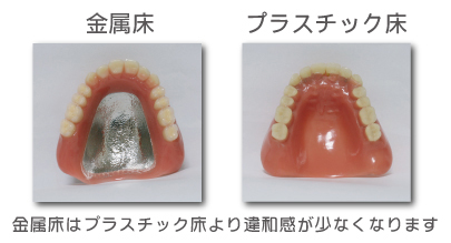 金属床なら薄くても丈夫